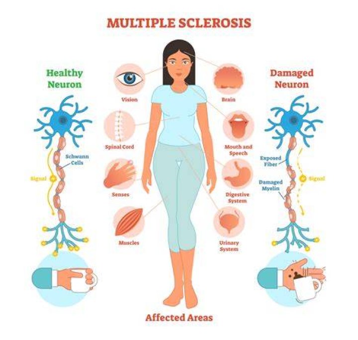 Can MS affect impulse control?