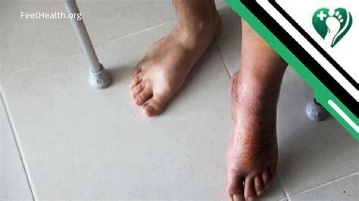 How long do you stay in the hospital for foot surgery?