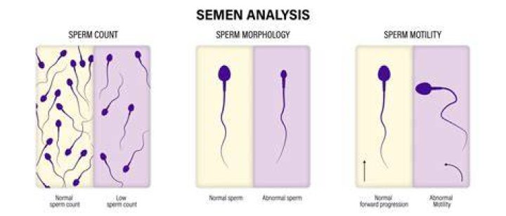 What kind of doctor checks sperm count?